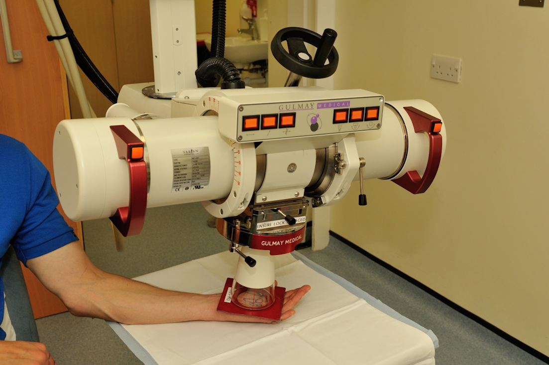 Figure 2: Treatment of a patient with radiotherapy on a low energy X-ray machine 