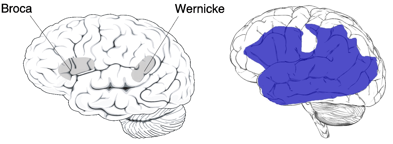 Abbildung 3: In grau eingefärbte schematische Darstellung typischer neuroanatomischer Lokalisationen für die Broca-und Wernicke-Aphasie (linkes Gehirn; Quelle: National Institute on Deafness and Other Communication Disorders; https://www.nidcd.nih.gov/sites/default/files/Documents/health/voice/Aphasia6-1-16.pdf; Public Domain) und der globalen Aphasie (blau eingefärbt, rechtes Gehirn; Quelle: https://commons.wikimedia.org/wiki/File:Aphasia.jpg; CC BY-SA 3.0). 